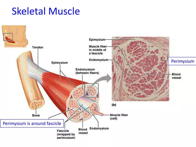 How to Support a Loved One with a Skeletal Muscle Condition