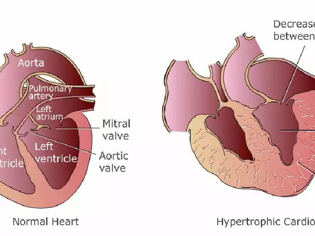 Cyclosporine and the Heart: A Comprehensive Guide