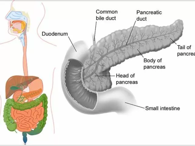 Managing Pancreatic Duct Blockage: Tips for Caregivers