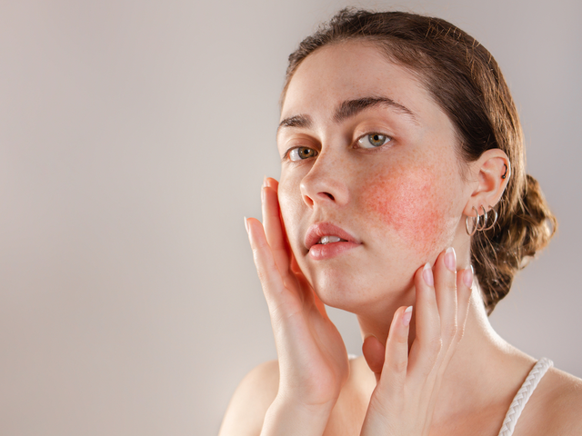 Skin Chafe and Skin Conditions: How to Tell the Difference